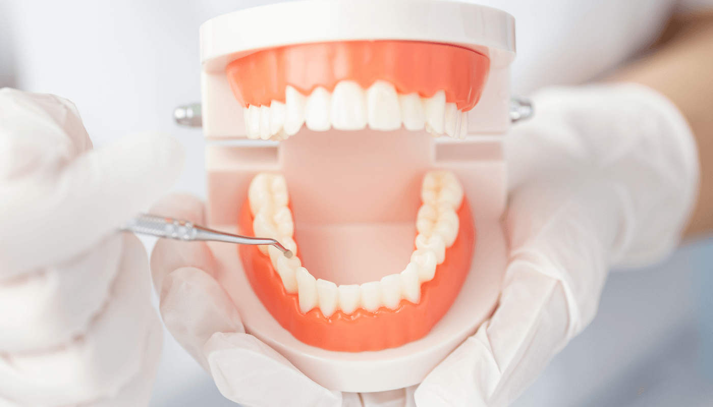 開いた状態の歯の模型写真