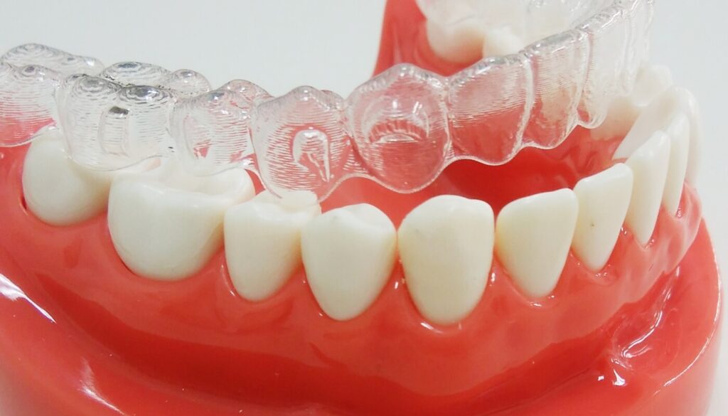 歯の模型とマウスピース型の矯正装置