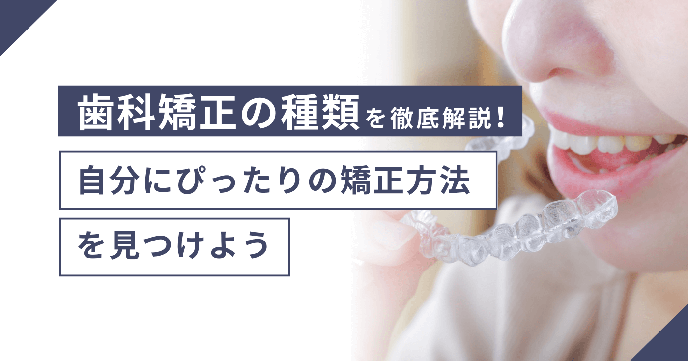 歯科矯正の種類を徹底解説！自分にぴったりの矯正方法を見つけよう