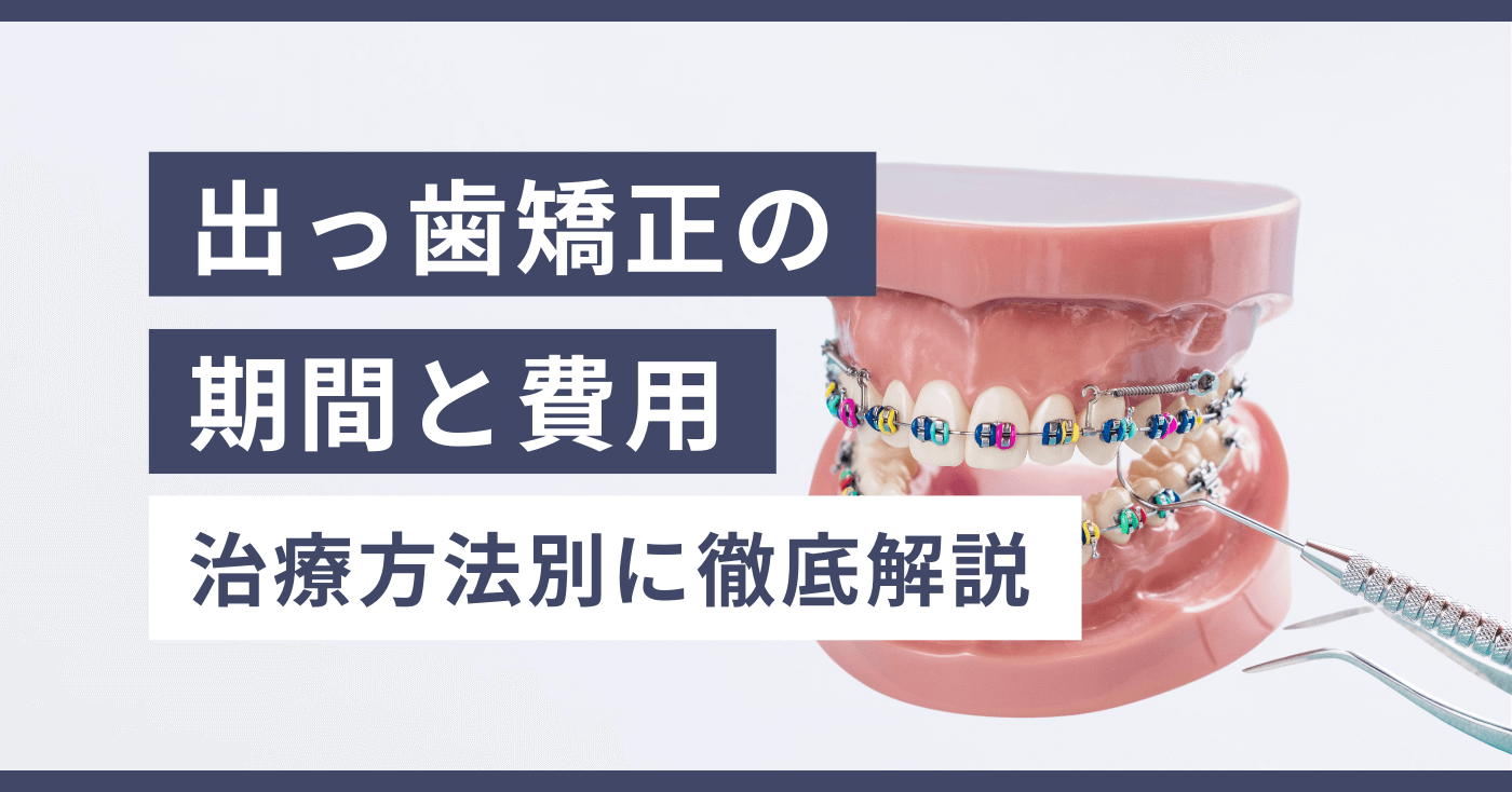 出っ歯矯正の期間と費用｜治療方法別に徹底解説