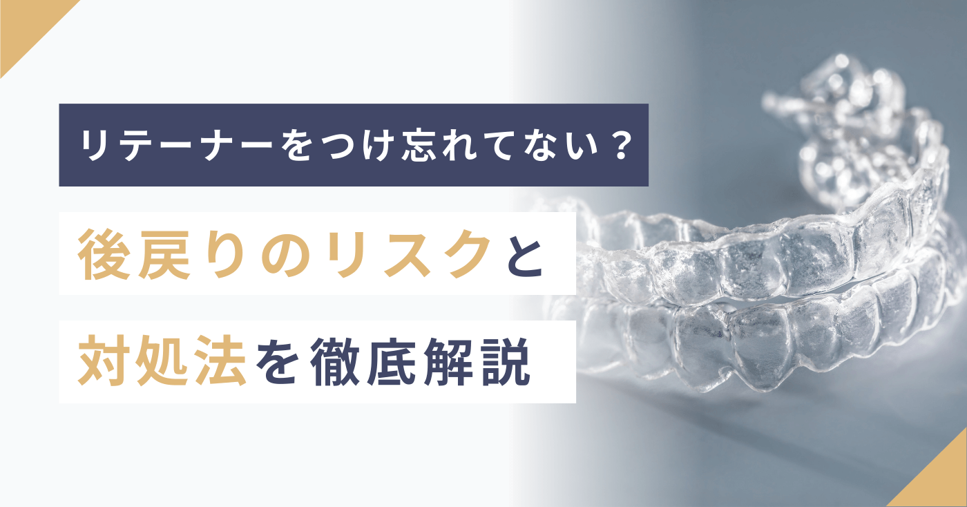 リテーナーをつけ忘れてない？後戻りのリスクと対処法を徹底解説