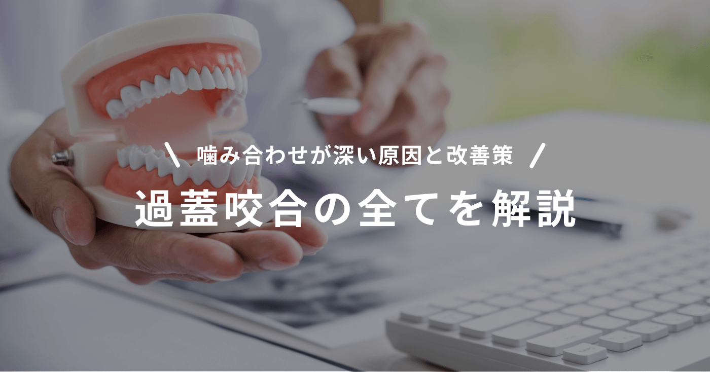 噛み合わせが深い原因と改善策：過蓋咬合の全てを解説