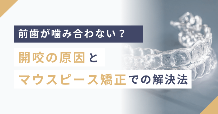 前歯が噛み合わない？開咬の原因とマウスピース矯正での解決法